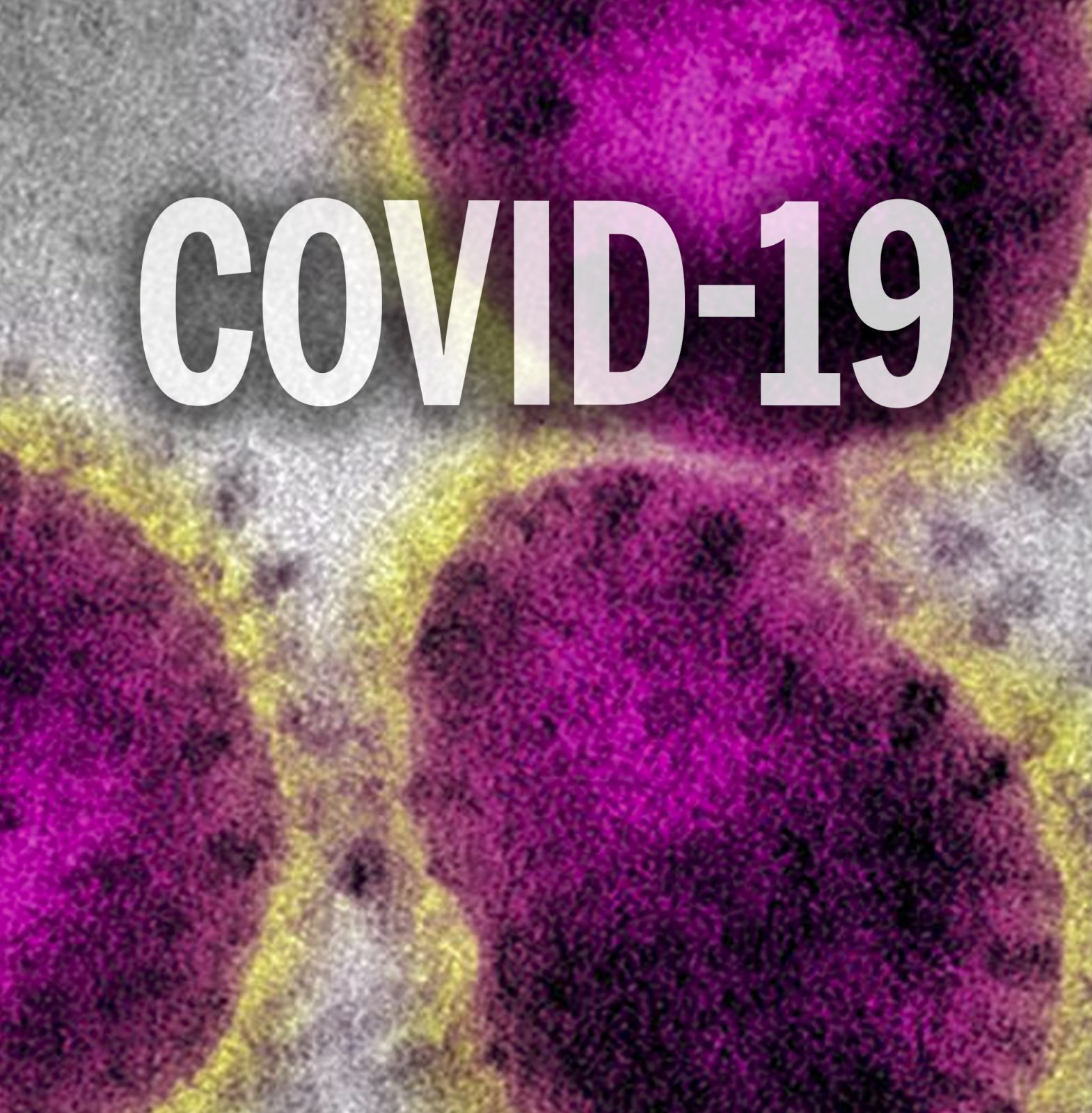 Deux nouveaux cas de COVID-19 en Mauricie et au Centre-du-Québec